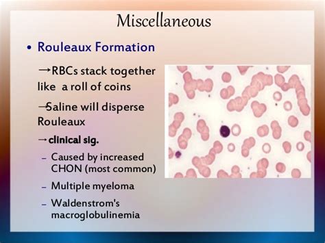 causes of rouleaux formation.